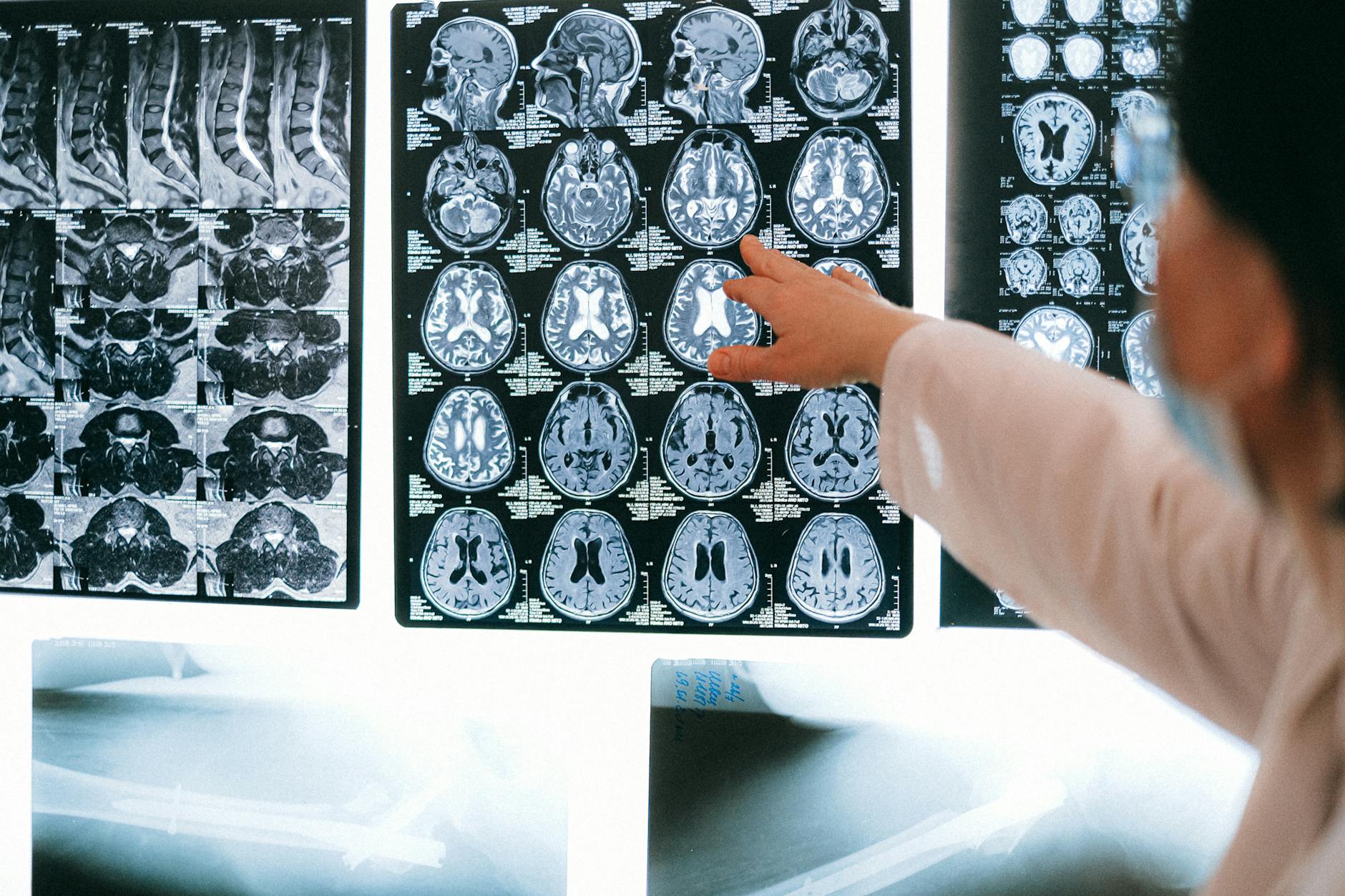 Outsource Medical Billing for Neurology Practices 2026