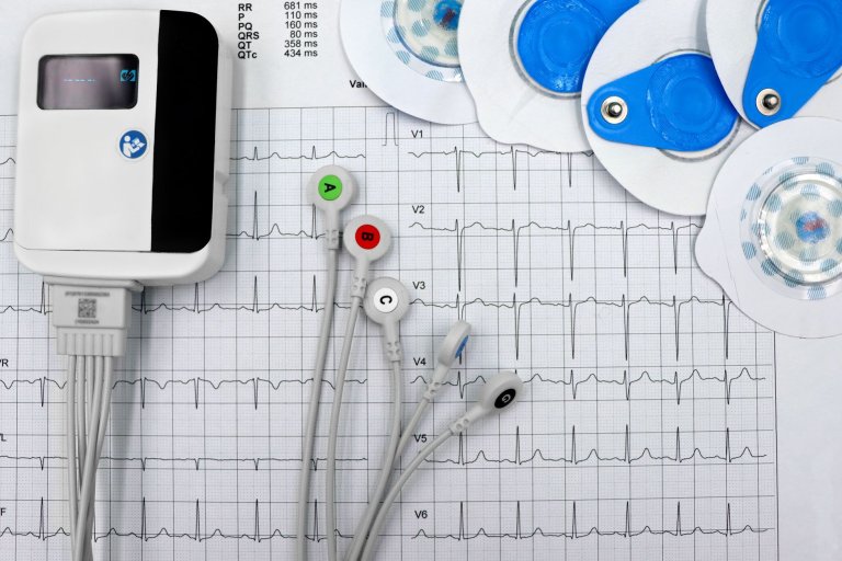 Cardiac Stress Test Billing: CPT 93015-93018 Done Right