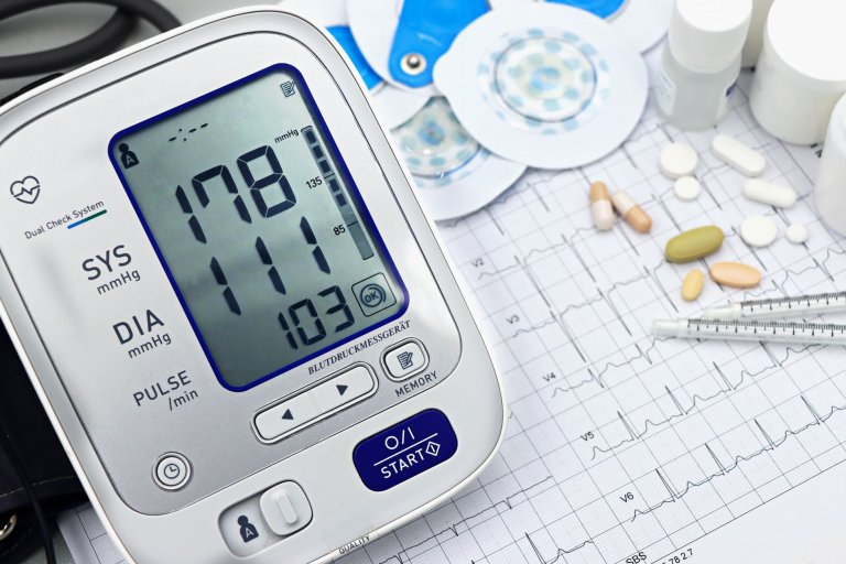 Coronary CT Angiography Billing: CPT 75574 Guide