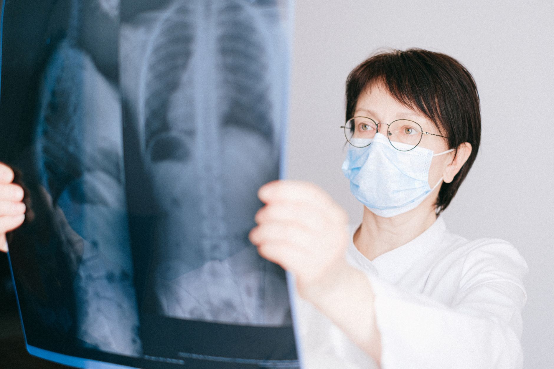 Cardiologist reviewing coronary CT angiography images on monitor, illustrating CPT 75574 coronary CT angiography billing workflow